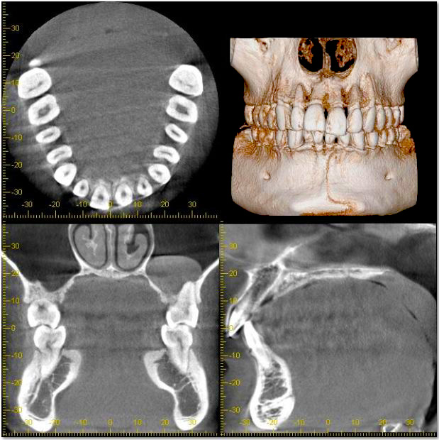 歯や関節の構造を分析 「CT（三次元立体画像）」